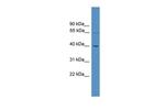UTP18 Antibody in Western Blot (WB)