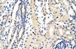 EXOSC3 Polyclonal Antibody