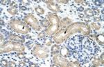 RBM38 Antibody in Immunohistochemistry (Paraffin) (IHC (P))