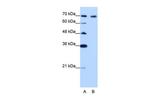 CDKN2AIP Polyclonal Antibody