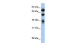 STRBP Polyclonal Antibody