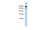 XRN1 Polyclonal Antibody
