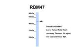 RBM47 Antibody in Western Blot (WB)