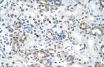 LSM2 Polyclonal Antibody