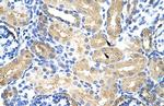 MTHFSD Polyclonal Antibody