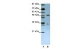 UPF3B Antibody in Western Blot (WB)