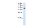 NOC4L Antibody in Western Blot (WB)