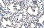 CPSF7 Polyclonal Antibody