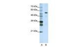 CPSF7 Antibody in Western Blot (WB)