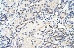 MRM1 Polyclonal Antibody
