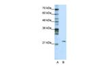 MRM1 Antibody in Western Blot (WB)