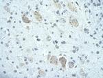 FIP1L1 Antibody in Immunohistochemistry (Paraffin) (IHC (P))
