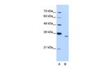 RBM4B Antibody in Western Blot (WB)