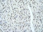 SRSF8 Antibody in Immunohistochemistry (Paraffin) (IHC (P))