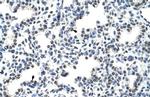hnRNP LL Antibody in Immunohistochemistry (Paraffin) (IHC (P))