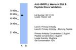 hnRNP LL Antibody in Western Blot (WB)