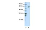 hnRNP LL Antibody in Western Blot (WB)