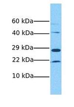 RBM24 Antibody in Western Blot (WB)