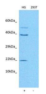 RBM24 Antibody in Western Blot (WB)