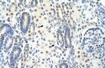 SF1 Polyclonal Antibody