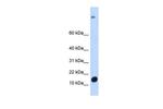 C6orf201 Antibody in Western Blot (WB)