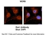 WDR5 Antibody in Immunohistochemistry (IHC)