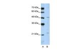 WDR12 Antibody in Western Blot (WB)