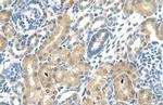 KHK Polyclonal Antibody