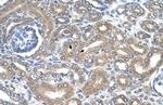 NKCC2 Polyclonal Antibody
