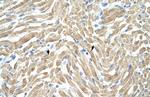TPM1 Polyclonal Antibody