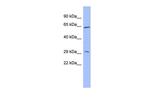 HRG Polyclonal Antibody