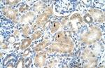 MAT1A Polyclonal Antibody