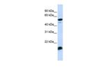 C4BPA Antibody in Western Blot (WB)