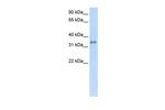 Carbonic Anhydrase IV Antibody in Western Blot (WB)