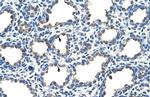 EMP2 Polyclonal Antibody