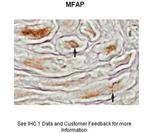 MFAP4 Polyclonal Antibody
