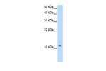 SMPX Polyclonal Antibody