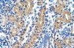 HSD17B1 Polyclonal Antibody