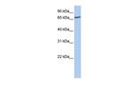 LSS Polyclonal Antibody