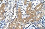 CYP4A22 Polyclonal Antibody