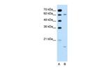CYP4A22 Antibody in Western Blot (WB)
