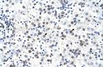 FECH Polyclonal Antibody
