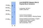 RhoBTB1 Antibody in Western Blot (WB)