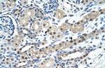 IGSF1 Polyclonal Antibody