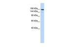 Periplakin Polyclonal Antibody