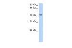 PSG5 Polyclonal Antibody