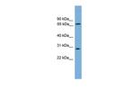 SEMG2 Polyclonal Antibody