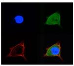 SLC2A5 Polyclonal Antibody