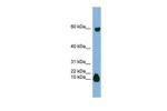 STATH Polyclonal Antibody