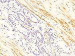 TGM4 Antibody in Immunohistochemistry (IHC)